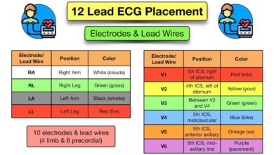 leads on ecg